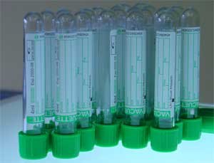 LIQUIDOS IONICOS la alternativa verde para la industria