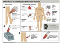 Algunas enfermedades o patolog�as en que se aplica OZONO con �xito