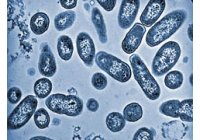 Cadbury afronta el proceso judicial por el brote de salmonella en su f�brica