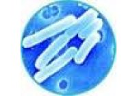 Investigadores espa�oles identifican bacterias l�cticas resistentes a los antibi�ticos