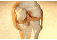 Ozono para Regenerar el Cart�lago de la Rodilla