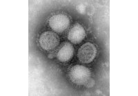 Preguntas y respuestas sobre la gripe porcina